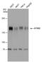 Ataxin 2 antibody, PA5-40131, Invitrogen Antibodies, Western Blot image 