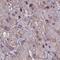 Ankyrin Repeat Domain 30B antibody, HPA060455, Atlas Antibodies, Immunohistochemistry paraffin image 