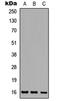 Ataxin 7 Like 1 antibody, LS-C354553, Lifespan Biosciences, Western Blot image 