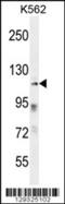 Zinc Finger Protein 99 antibody, 56-154, ProSci, Western Blot image 