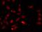 Heterogeneous Nuclear Ribonucleoprotein F antibody, GTX33243, GeneTex, Immunocytochemistry image 