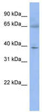 Zinc Finger Protein 302 antibody, TA345253, Origene, Western Blot image 