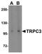Transient Receptor Potential Cation Channel Subfamily C Member 3 antibody, A01472-1, Boster Biological Technology, Western Blot image 