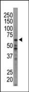 Eukaryotic Translation Initiation Factor 2 Alpha Kinase 1 antibody, MBS9208228, MyBioSource, Western Blot image 