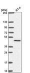 Solute Carrier Family 29 Member 3 antibody, NBP2-58230, Novus Biologicals, Western Blot image 