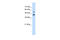 GTP Binding Protein 2 antibody, 29-770, ProSci, Enzyme Linked Immunosorbent Assay image 