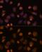 Intercellular Adhesion Molecule 1 antibody, GTX32663, GeneTex, Immunocytochemistry image 