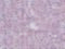Interleukin 1 Receptor Associated Kinase 1 antibody, PM-5317, ProSci, Immunohistochemistry paraffin image 