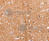 Histone Deacetylase 7 antibody, A2970, ABclonal Technology, Immunohistochemistry paraffin image 