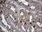 Protein Tyrosine Phosphatase Non-Receptor Type 22 antibody, LS-C795313, Lifespan Biosciences, Immunohistochemistry paraffin image 