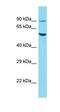 R3H Domain And Coiled-Coil Containing 1 Like antibody, orb331379, Biorbyt, Western Blot image 