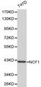 Neutrophil Cytosolic Factor 1 antibody, LS-C192401, Lifespan Biosciences, Western Blot image 
