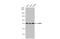 Far Upstream Element Binding Protein 1 antibody, GTX104579, GeneTex, Western Blot image 