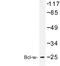 BCL2L2-PABPN1 Readthrough antibody, LS-C177042, Lifespan Biosciences, Western Blot image 