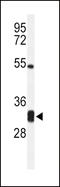 Neb-1 antibody, 64-029, ProSci, Western Blot image 