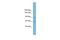 TBC1 Domain Containing Kinase antibody, A11098, Boster Biological Technology, Western Blot image 