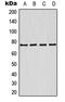 Potassium Voltage-Gated Channel Subfamily Q Member 1 antibody, LS-C352422, Lifespan Biosciences, Western Blot image 