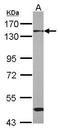 RNA Binding Motif Protein 26 antibody, GTX120227, GeneTex, Western Blot image 