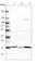 ATP Synthase F1 Subunit Delta antibody, HPA002865, Atlas Antibodies, Western Blot image 