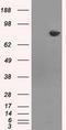 Histone Deacetylase 10 antibody, GTX84387, GeneTex, Western Blot image 