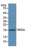 Eukaryotic Translation Initiation Factor 4E Binding Protein 1 antibody, LS-C301115, Lifespan Biosciences, Western Blot image 