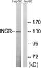 Insulin Receptor antibody, LS-C118307, Lifespan Biosciences, Western Blot image 