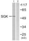 Serum/Glucocorticoid Regulated Kinase 1 antibody, LS-C117780, Lifespan Biosciences, Western Blot image 