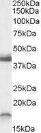 Cholinergic Receptor Nicotinic Beta 3 Subunit antibody, 45-401, ProSci, Western Blot image 