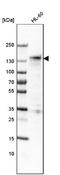 Myocardin Related Transcription Factor A antibody, NBP2-59047, Novus Biologicals, Western Blot image 