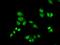 General Transcription Factor IIF Subunit 2 antibody, LS-C748546, Lifespan Biosciences, Immunofluorescence image 