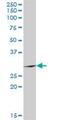 Testis Specific Serine Kinase 6 antibody, H00083983-D01P, Novus Biologicals, Western Blot image 