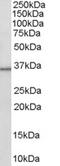 Hydroxysteroid 11-Beta Dehydrogenase 1 antibody, 45-748, ProSci, Western Blot image 