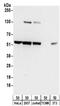 Tryptophanyl-TRNA Synthetase antibody, NBP2-32185, Novus Biologicals, Western Blot image 