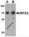 CREB Regulated Transcription Coactivator 2 antibody, 7325, ProSci Inc, Western Blot image 