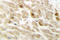 Core-Binding Factor Subunit Beta antibody, LS-C176931, Lifespan Biosciences, Immunohistochemistry frozen image 