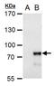 Methyl-CpG Binding Domain 4, DNA Glycosylase antibody, PA5-78272, Invitrogen Antibodies, Western Blot image 