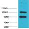 Calcium Voltage-Gated Channel Auxiliary Subunit Alpha2delta 1 antibody, A04282-1, Boster Biological Technology, Western Blot image 