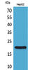 Dual Specificity Phosphatase 3 antibody, STJ96593, St John