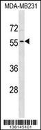 Adenosine Deaminase TRNA Specific 1 antibody, 59-548, ProSci, Western Blot image 