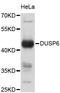 Dual specificity protein phosphatase 6 antibody, STJ111007, St John