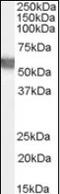 Glucose-6-Phosphate Dehydrogenase antibody, orb88782, Biorbyt, Western Blot image 