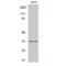 Cyclin Dependent Kinase 2 antibody, LS-C382653, Lifespan Biosciences, Western Blot image 