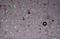 Perforin 1 antibody, NBP1-45774, Novus Biologicals, Immunocytochemistry image 