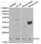Insulin Like Growth Factor 1 antibody, A0303, ABclonal Technology, Western Blot image 