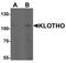 Klotho antibody, PA5-21078, Invitrogen Antibodies, Western Blot image 