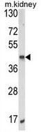 AlkB Homolog 3, Alpha-Ketoglutaratedependent Dioxygenase antibody, GTX81095, GeneTex, Western Blot image 