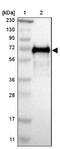 Serine Peptidase Inhibitor, Kunitz Type 1 antibody, NBP1-89720, Novus Biologicals, Western Blot image 