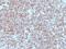 Major Histocompatibility Complex, Class II, DR Alpha antibody, NBP2-48105, Novus Biologicals, Immunohistochemistry paraffin image 