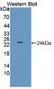 Achaete-Scute Family BHLH Transcription Factor 1 antibody, LS-C374951, Lifespan Biosciences, Western Blot image 