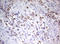 TIMELESS-interacting protein antibody, LS-C789741, Lifespan Biosciences, Immunohistochemistry paraffin image 